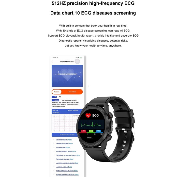 ET310 1.39 inch IPS Screen IP67 Waterproof Silicone Band Smart Watch, Support Body Temperature Monitoring / ECG (Black)