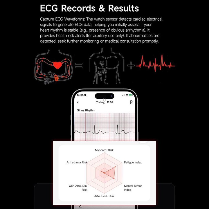 E900 Screenless BT Smart Bracelet Silicone Strap, Support ECG Heart Health Analysis / Health Monitoring(Pink)
