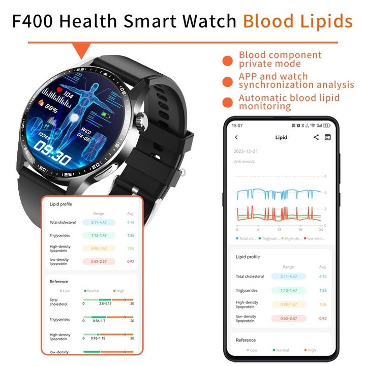 F400 1.55 Inch Screen Smart Watch Support ECG/ Blood Oxygen / Blood Sugar / 150+ Sports Mode, Color: Black Gray Silicone